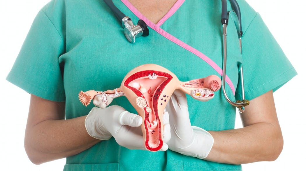 Le syndrome des ovaires polykystiques : causes et remèdes du diagnostic